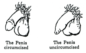 Drawing of circumcised penis showing exposed glans and an intact or uncircumcised penis showing the glans covered