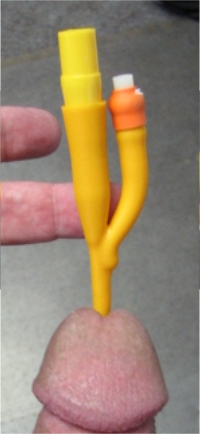 Silicone catheter extending from the glans of an erect penis, catheter has a sealing plug